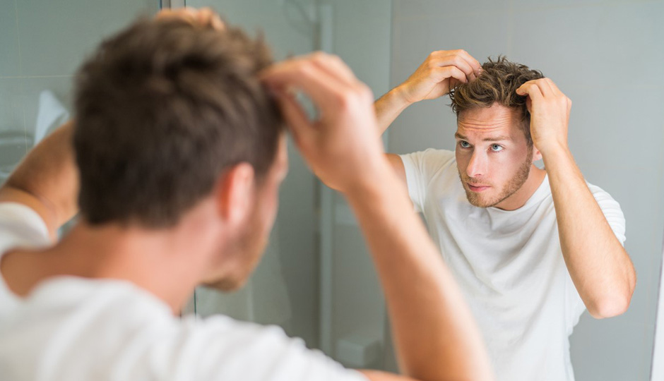 Male Pattern Hair Loss May Be Linked to Five Gene Variants